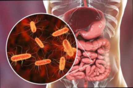 Antiparasitaire humain Fluvermal
